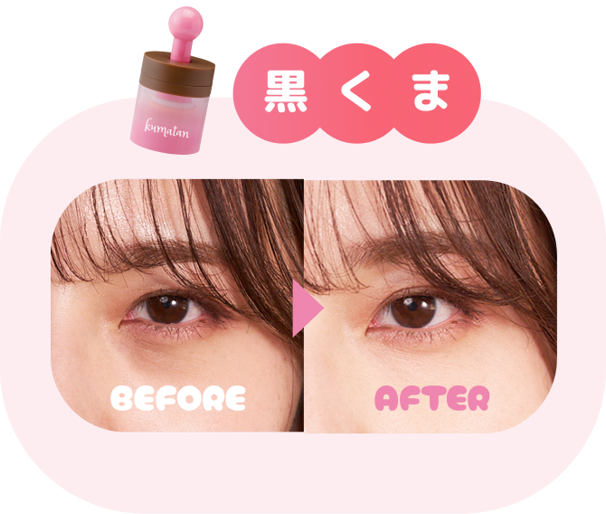 黒くま