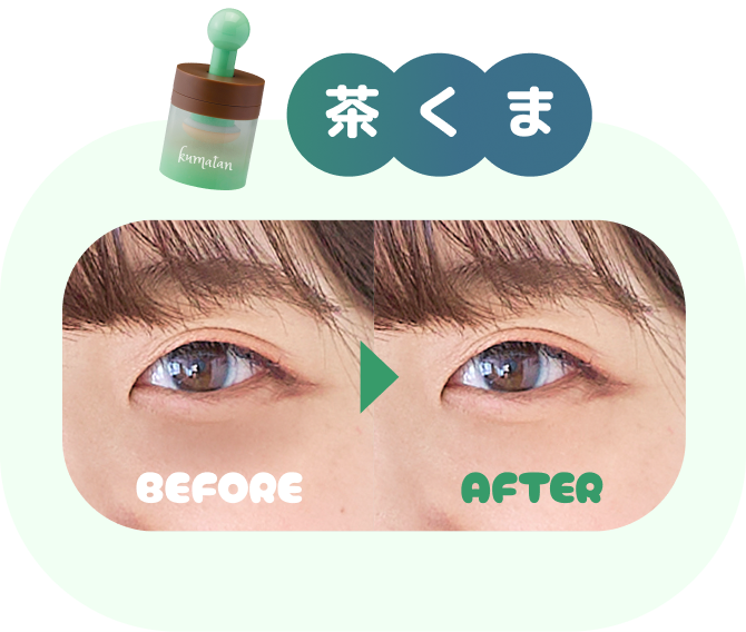 茶くま