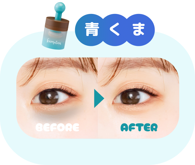 青くま