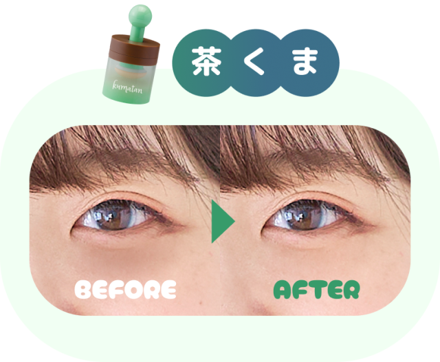 茶くま