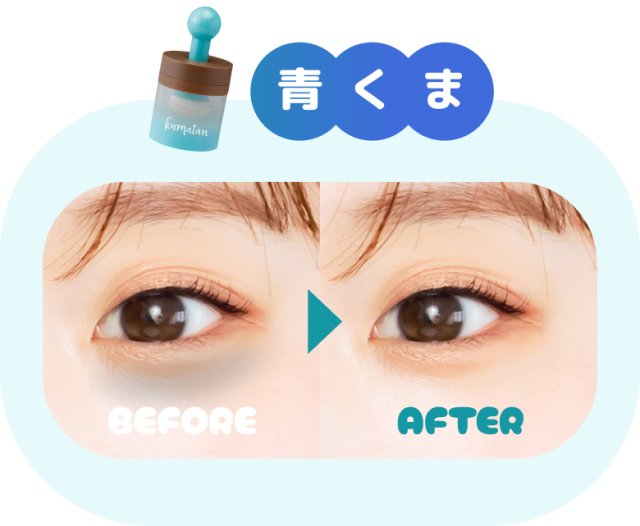 青くま